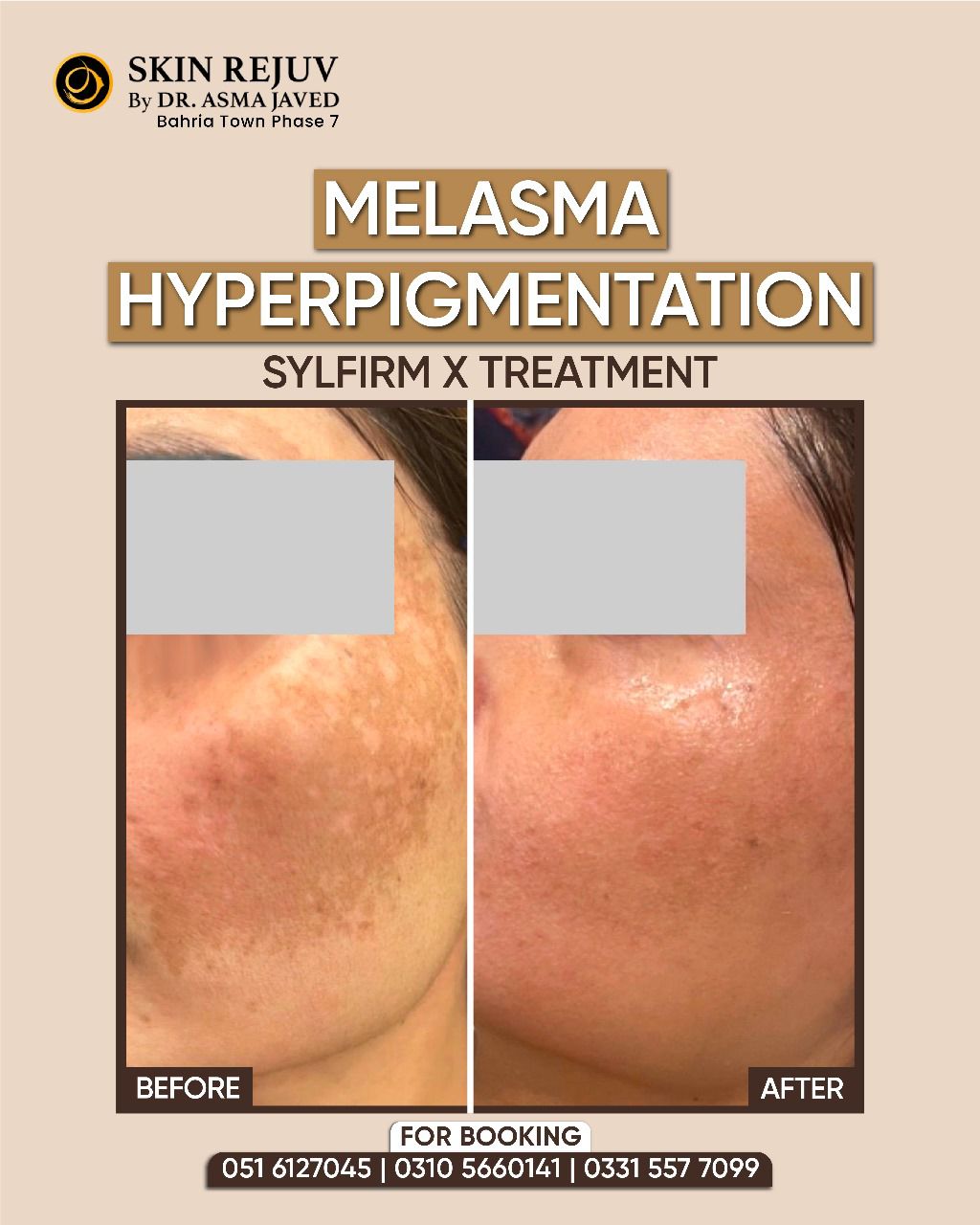 Before After Treatment 7